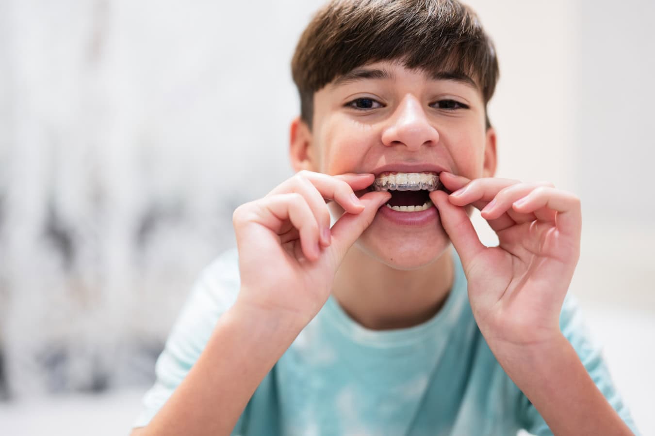 Clear Aligners for Teens