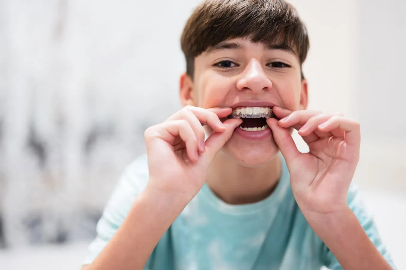 Clear Aligners for Teens